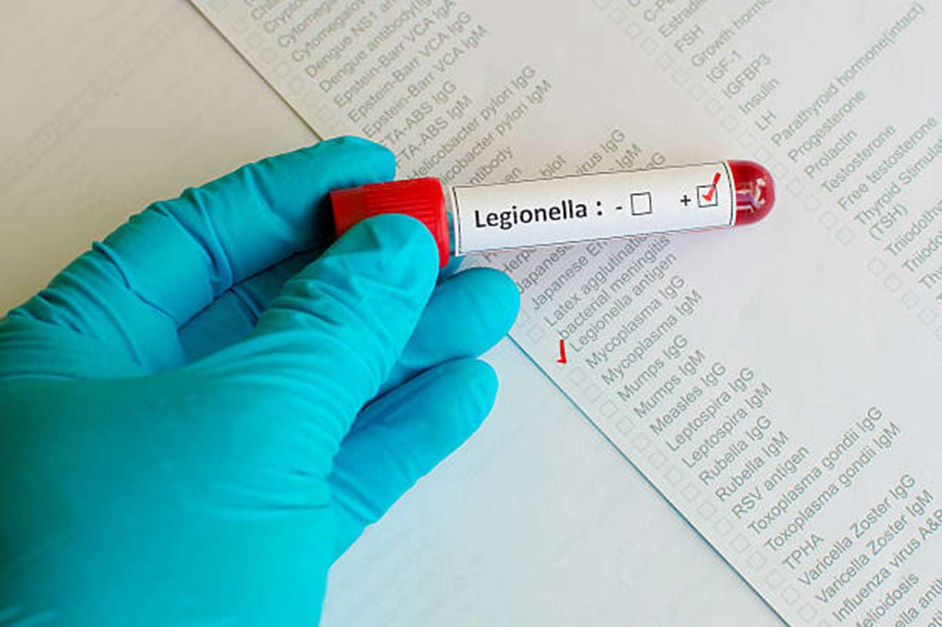 Lejyoner hastalığı nedir belirtileri nelerdir? Lejyoner hastalığı nedir belirtileri nelerdir?
